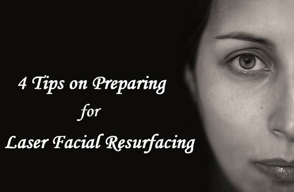 4 Tips to Prepare for Laser Face Resurfacing