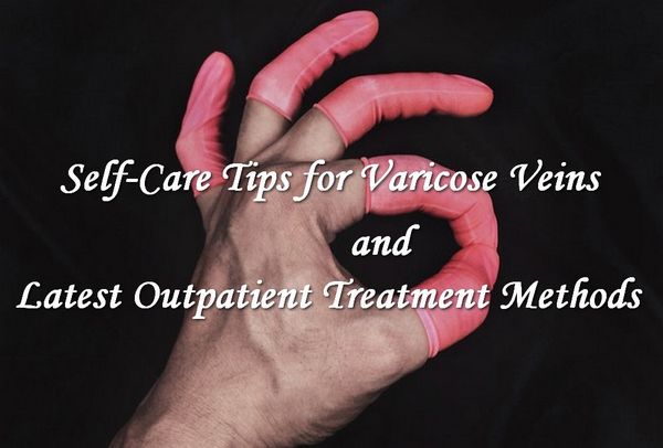 Self Care Tips for Varicose Veins and the Latest Outpatient Treatment Methods