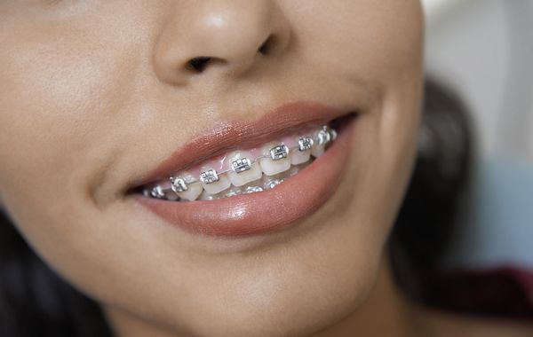 Significance of Orthodontics in Oral Health Care